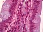 ATF4 Antibody
